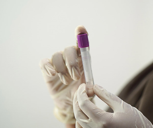 blood test