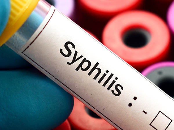 syphilis-vials_600x450